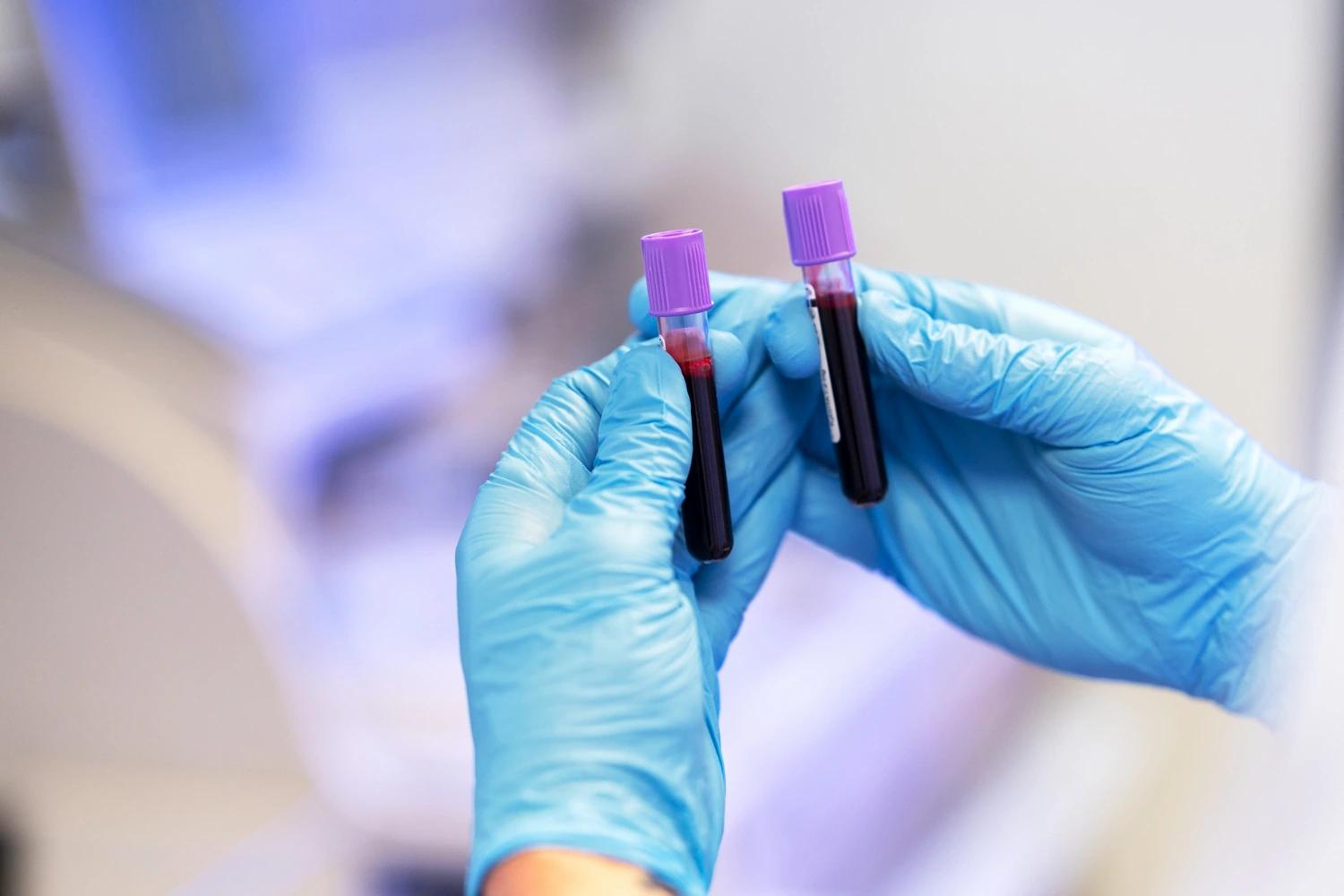 HCM no exame de sangue: Entenda o que significa e quando se preocupar